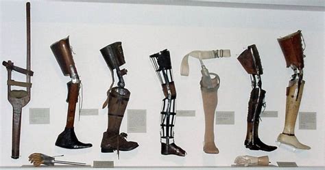 The Development Of Artificial Limbs Prosthetic Leg Prosthetics Amputee