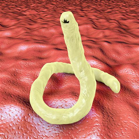 Ancylostoma Hookworm