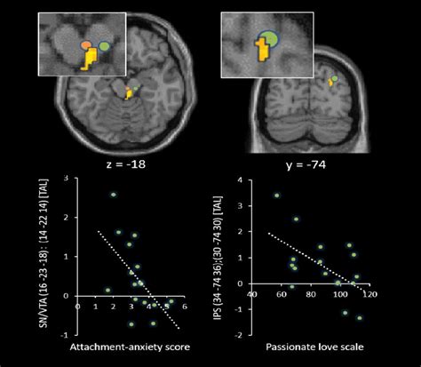 Significant Negative Correlations Between Sn Vta Activity Showing Download Scientific Diagram