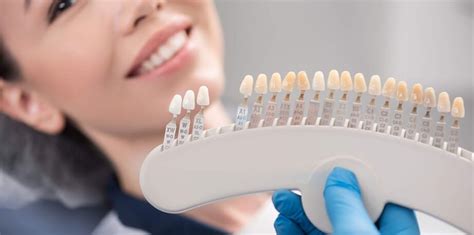 Dental Veneer Cost In Dubai Euromed Clinic