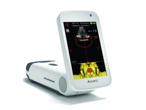 Handheld Ultrasound Device Launches in Middle East