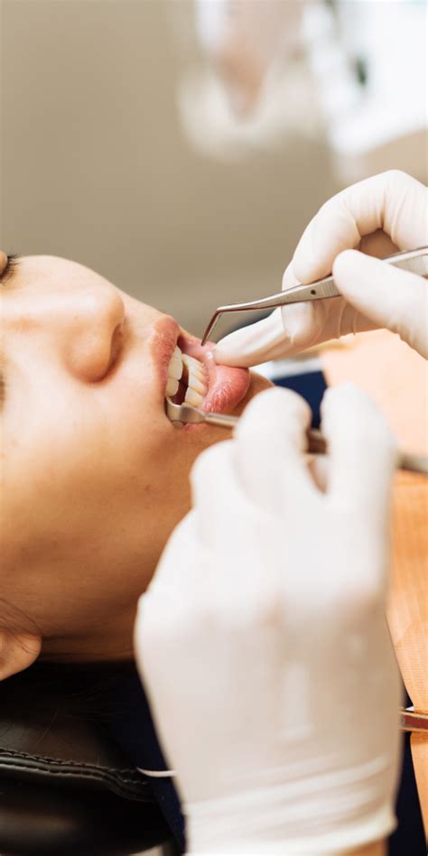 ¿qué Es La Periodoncia Beneficios Clínica Kranion