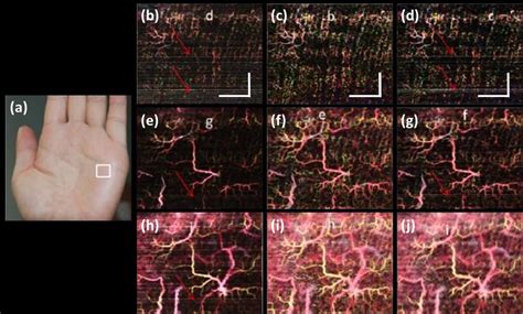 Doppler Optical Coherence Tomography Doct Images Of The Palm Of An