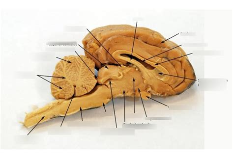 Sheep Brain Sagittal View Diagram Quizlet