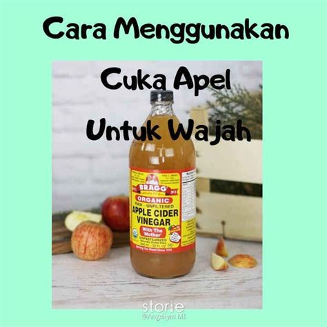 Cuka Apel Obat Apa Sue Mackay