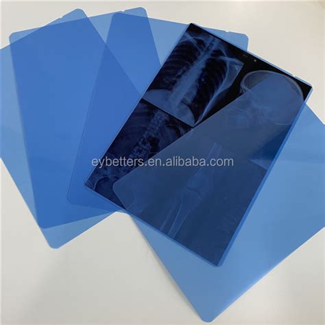 Factory Price Direct Sale A4 Size Sheets Blue Inkjet Medical Film For