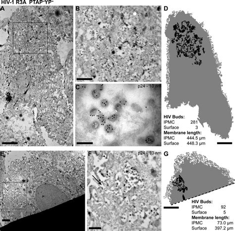 Immuno Electron Microscopy Em Of Monocyte Derived Macrophages Mdms