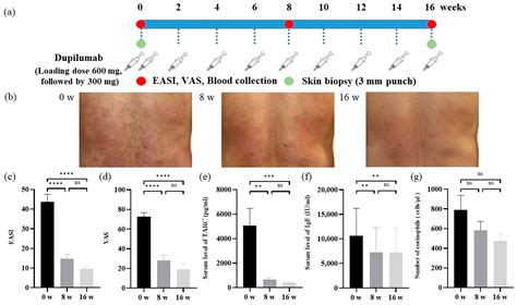 Cells Free Full Text Effects Of Dupilumab On Itch Related Events In