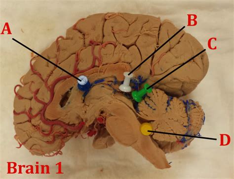 Neuroanatomy Lab Exam Flashcards Quizlet