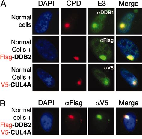 The Ddb1 Cul4addb2 Ubiquitin Ligase Is Deficient In Xeroderma