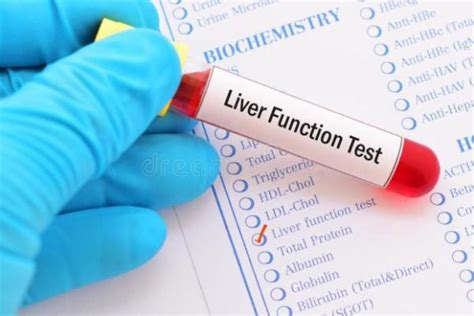 LIVER FUNCTION TEST – Sunrise Diagnostic Laboratory