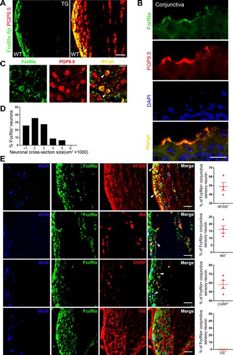 Analysis Of Fc Ri Expression In Conjunctiva Innervating Sensory