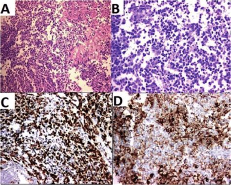 Histological Examination Of Specimen A Hematoxylin And Eosin He