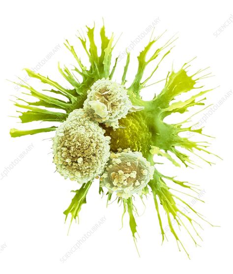 Alveolar Macrophage SEM Stock Image C046 3337 Science Photo Library