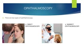 Ophthalmoscopy | PPT | Free Download