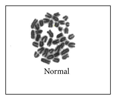 Photomicrographs Of Metaphase Bone Marrow Cells Week After