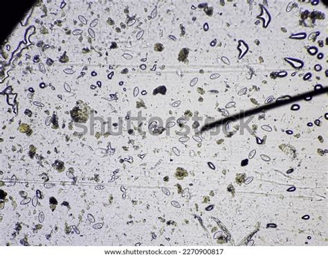 Pinworm Eggs Enterobius Vermicularis Scoth Tape Stock Photo 2270900817