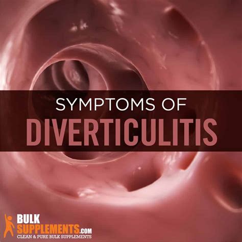 diverticulitis symptoms  treatment