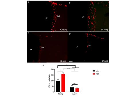 Svz Stem Cell Proliferation Is Transiently Increased By Calorie