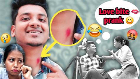 Love Bite 🫦 Prank On My Girlfriend Gone Wrong 😂😂😂 Prank Couplegoals