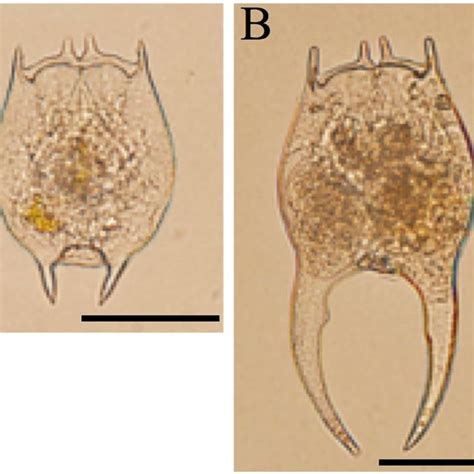 Pictures Of Brachionus Forficula With Short A And Long B Posterior