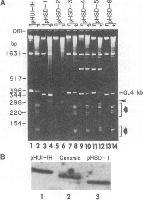 Human U1 RNA Genes Contain An Unusually Sensitive Nuclease S1 Cleavage