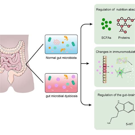 Pdf Gut Microbiota And Bone Diseases A Growing Partnership