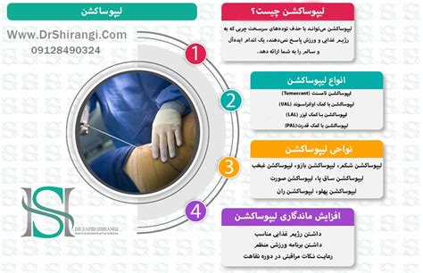 لیپوساکشن مراحل، مزایا و هزینه لاغری موضعی آپدیت 1401 دکتر سعید