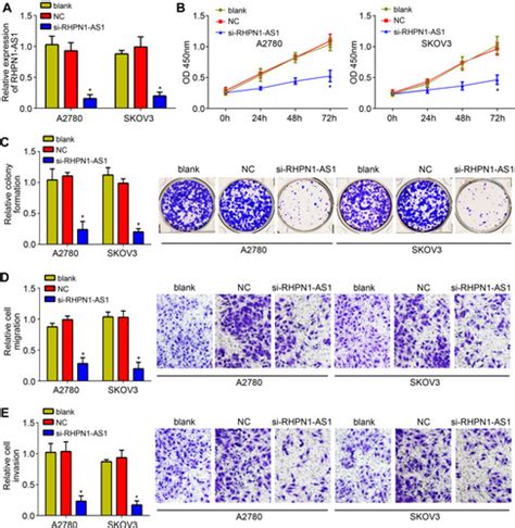 Full Article Lncrna Rhpn1 As1 Promotes Ovarian Cancer Growth And Invasiveness Through