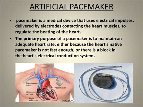 Hearts Pace Maker The Sinoatrial Node