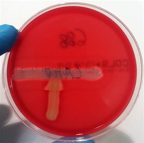 Streptococcus Agalactiae Streptococcus Grupo B