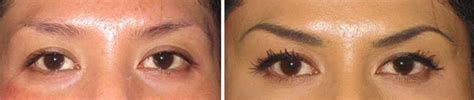 Permanent Makeup Denver Centennial Dtc Laser Aesthetics Of Colorado