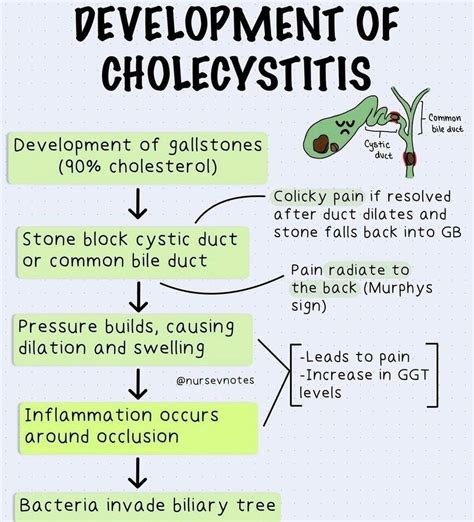 Development Of Cholecystitis Medizzy