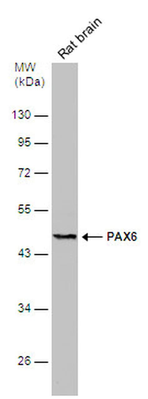 Pax6 Polyclonal Antibody Pa5 85374