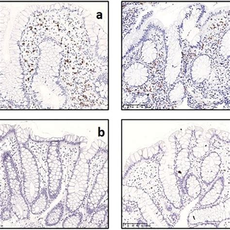 Immunohistochemical Identification Of Eosinophils With Epo In Rectal Download Scientific