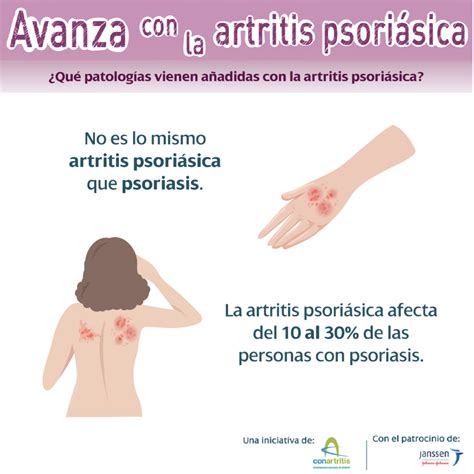 Un Diagnóstico Precoz Ayuda En La Calidad De Vida De Las Personas Con Artritis Psoriásica