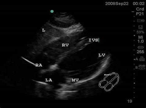 Echocardiography For Emergency Physicians Sonoguide