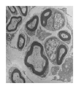 ((a), (b), and (c)) HE staining of transverse nerve slices from each... | Download Scientific ...