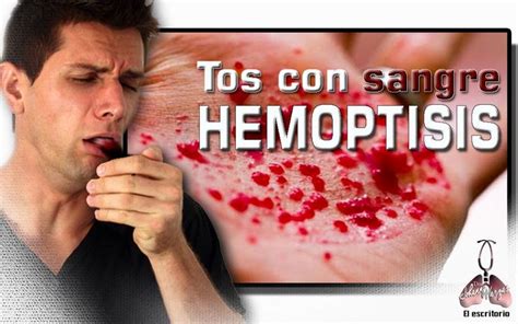 Toser Sangre Es El Primer S Ntoma De Que Algo No Va Bien Https