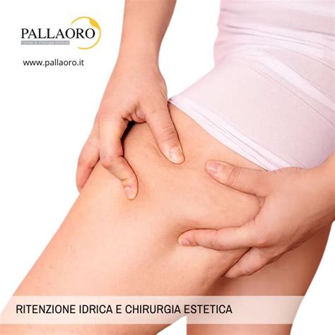 Ritenzione Idrica Glossario Di Chirurgia Estetica Clinica Pallaoro