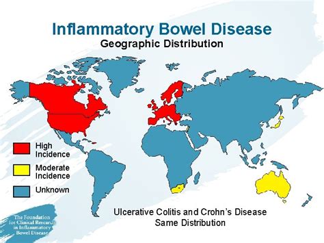 Advances In Inflammatory Bowel Disease 2004 Presented By