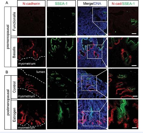 Figure 1 From N Cadherin Identifies Human Endometrial Epithelial