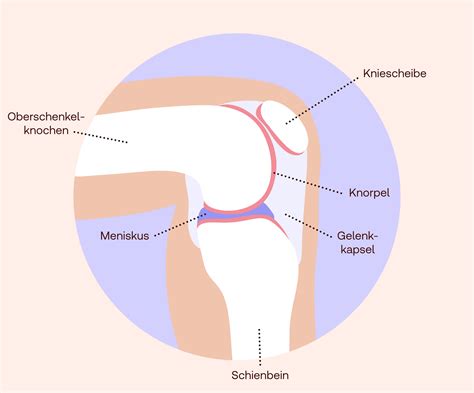 Knieschmerzen - Ursachen & Behandlung | Shop Apotheke
