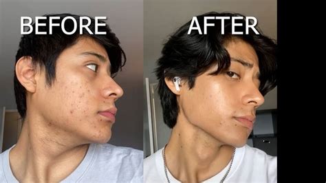 HOW TO GET A SHARP JAWLINE - Top 3 methods no one is talking about! | Jawline exercise, Jawline ...