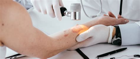 Rash Treatment Palm Beach Dermatology Group