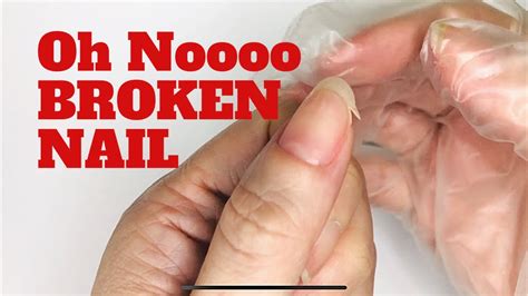 How To Fix A Broken Nail Diy Repair Broken Nail At Home Step By Step Youtube