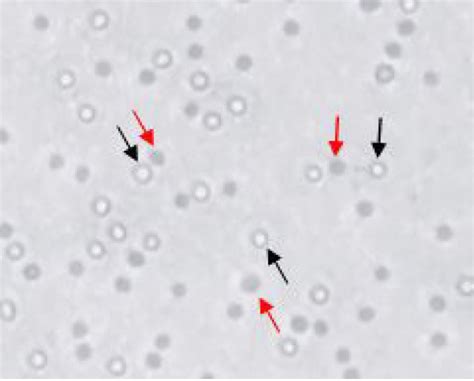 Methods And Protocols For Counting Cells Allcells