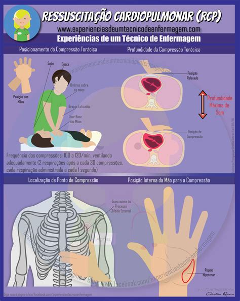 Manobras De Ressuscitação Cardiopulmonar - Ressuscitação Cardiopulmonar (RCP) | Enfermagem Ilustrada