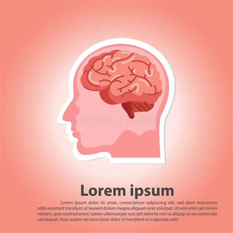 Human Brain Stroke Illustration Stock Vector Illustration Of Illness