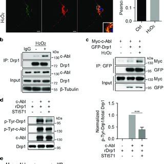 C Abl Interacts With And Phosphorylates Drp1 A Left Panel Primary